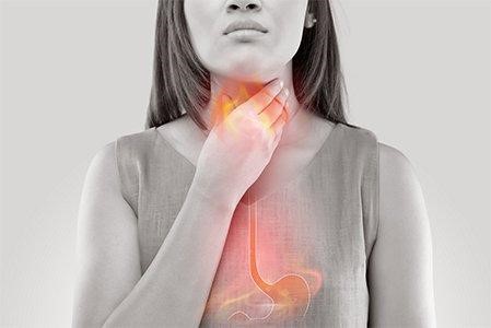 Gastroesophageal reflux disease